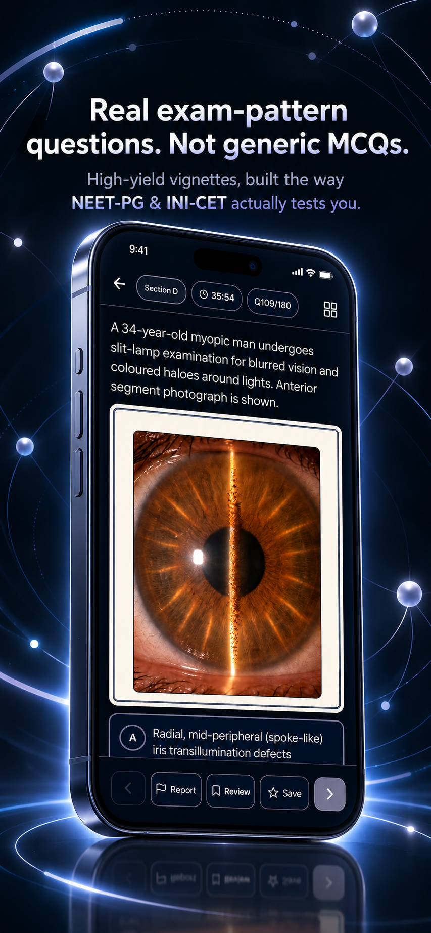 Clinical vignette with slit-lamp eye photograph and MCQ options
